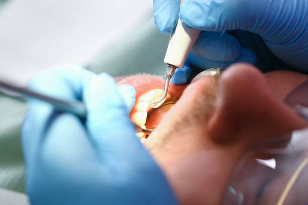 Best Emergency Gum Treatment in Chester, VA